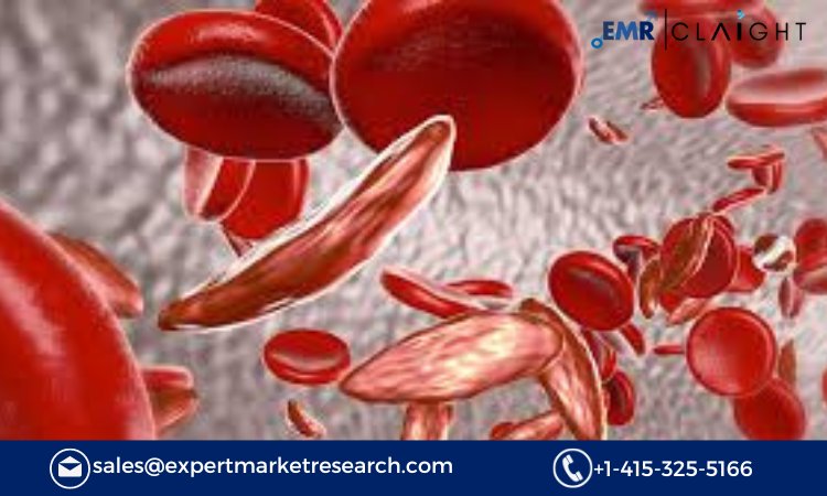 North America Hemoglobinopathies Market